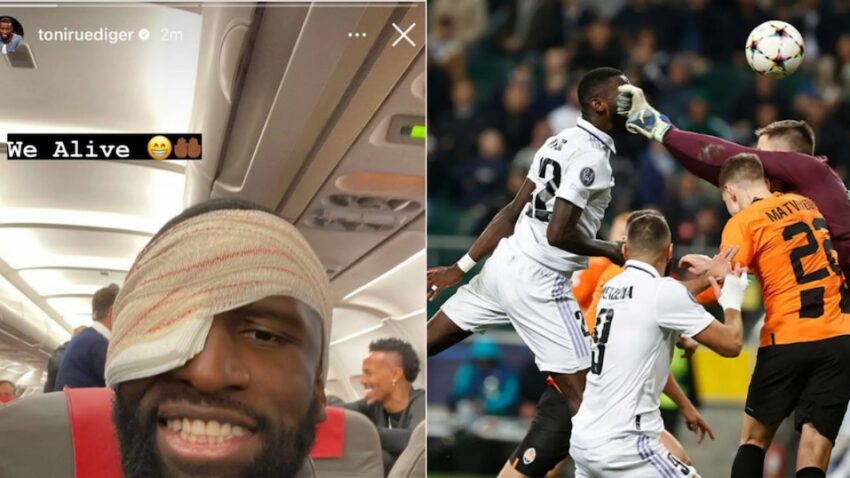 Rudiger Yuko Vizuri Baada ya Kushonwa Nyuzi 20