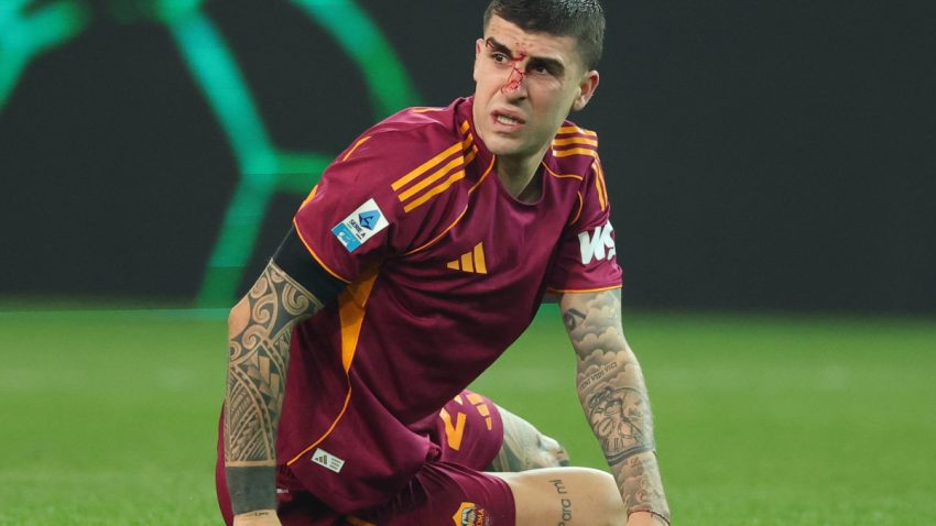 Beki wa Roma, Mancini, Afanyiwa Upasuaji Kutokana na Kuvunjika Pua